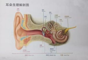 先天性耳蝸畸形