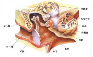 膽脂瘤型中耳炎