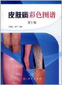 皮膚病彩色圖譜 皮膚病彩色圖譜