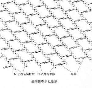 腦室炎