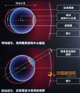 （圖）視路病例分析