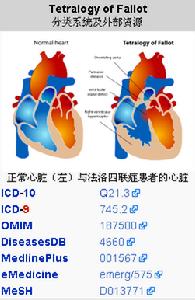 法洛氏四重症