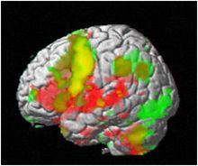 FMRI