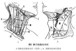 頸部淋巴結轉移癌