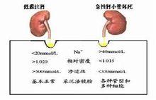 腎前性