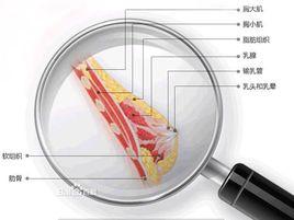 乳暈脫毛手術