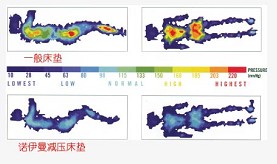 諾伊曼零壓枕