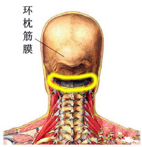 寰枕筋膜攣縮型頸椎病