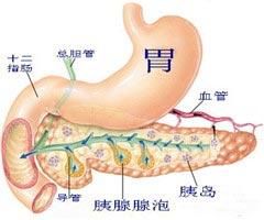 胰腺囊腫