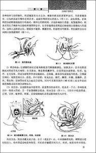 外陰硬化性苔癬