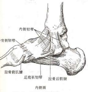 踝部急性韌帶損傷