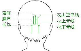 頭針療法