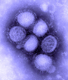 （圖）美國CDC發表的圓形甲型H1N1流感病毒形態的電子顯微鏡照片