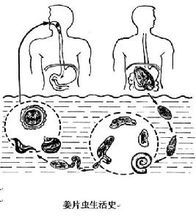 薑片蟲病