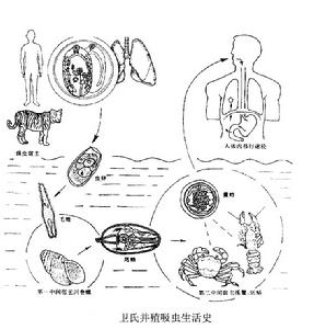 腦肺吸蟲病