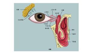 淚道阻塞