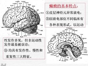 小兒癲癇