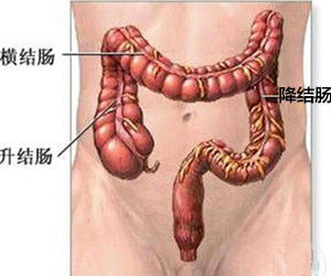 痙攣性結腸炎