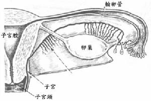 輸卵管膨出