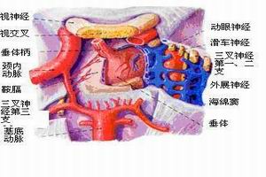 垂體卒中