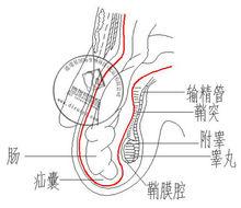 小兒疝氣使用小兒疝氣帶效果圖