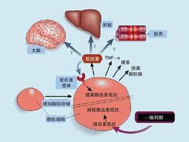 糖尿病綜合症