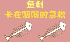 魚刺卡喉急救