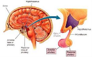 特發性低促性腺激素性性腺功能減退症