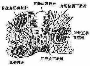 肛門直腸損傷