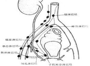 血道轉移