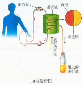 連續腎臟替代治療