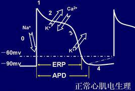 ERP[有效不應期]