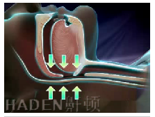 鼾頓止鼾效果