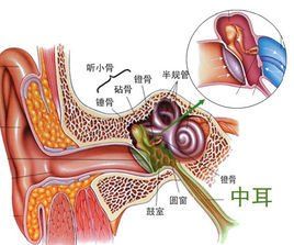 中耳乳突炎