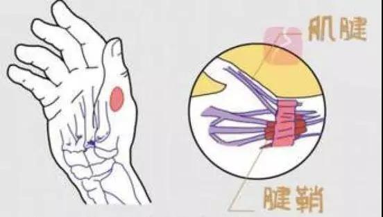 低頭玩手機=脖子扛50斤大米