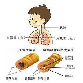 過敏性鼻炎咳嗽