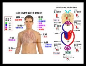 二氧化碳中毒