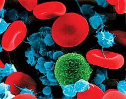 高原紅細胞增多症
