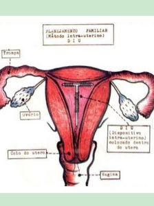 先天性卵巢發育不全