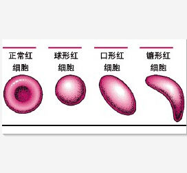 平均紅細胞血紅蛋白濃度