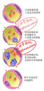 急性炎症