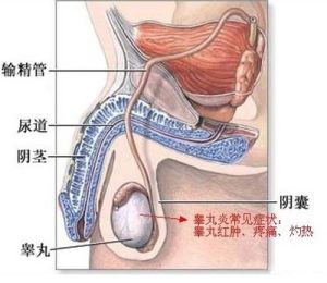 睪丸炎