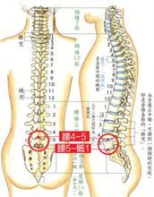 腰椎間盤