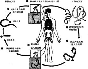 感染過程