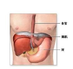 頑固性嗝逆