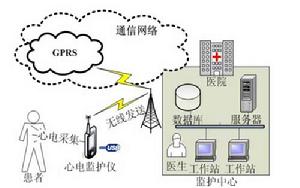 良性顱內高壓症