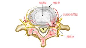 運動員胸背與腰背痛