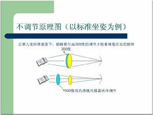 棱透組合