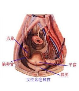 慢性盆腔疼痛