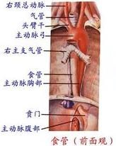 食管狹窄